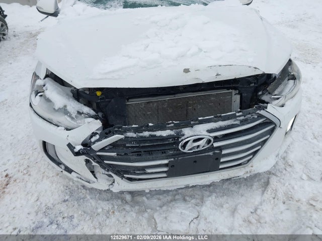 KMHD84LF7HU108536 Hyundai Elantra Gls