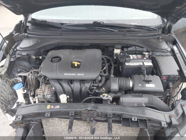 KMHD84LF1HU155657 Hyundai ELANTRA GL