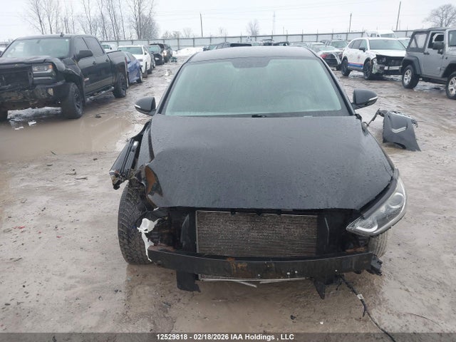 KMHD84LF1HU155657 Hyundai ELANTRA GL
