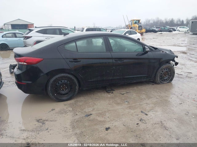KMHD84LF1HU155657 Hyundai ELANTRA GL