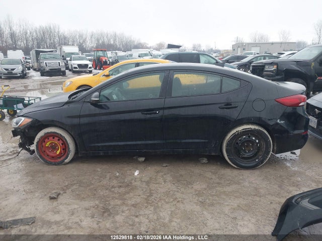 KMHD84LF1HU155657 Hyundai ELANTRA GL