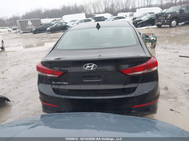 KMHD84LF1HU155657 Hyundai ELANTRA GL