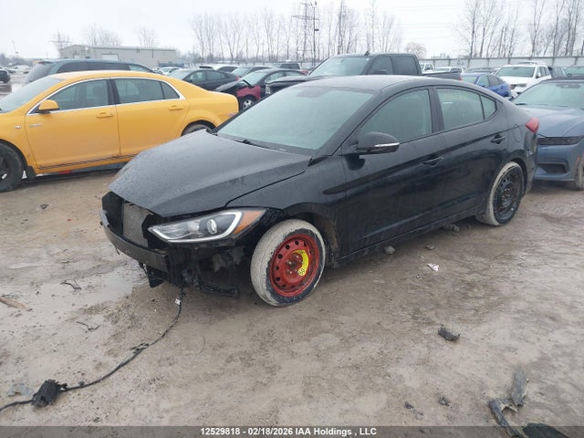KMHD84LF1HU155657 Hyundai ELANTRA GL