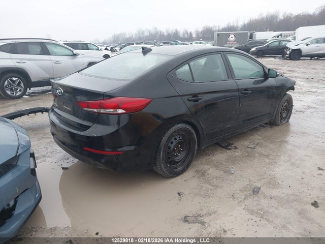 KMHD84LF1HU155657 Hyundai ELANTRA GL