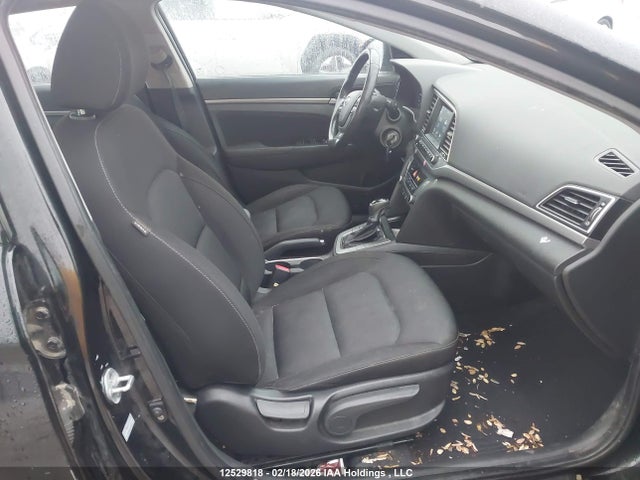 KMHD84LF1HU155657 Hyundai ELANTRA GL