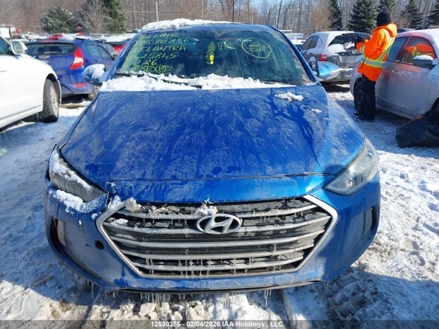 KMHD84LF5HU425845 Hyundai Elantra