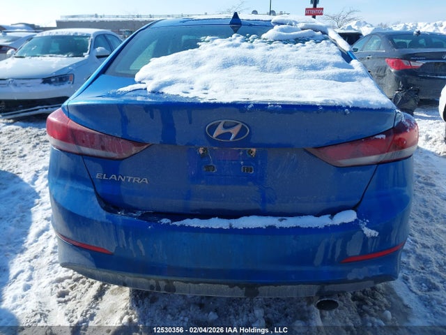 KMHD84LF5HU425845 Hyundai Elantra