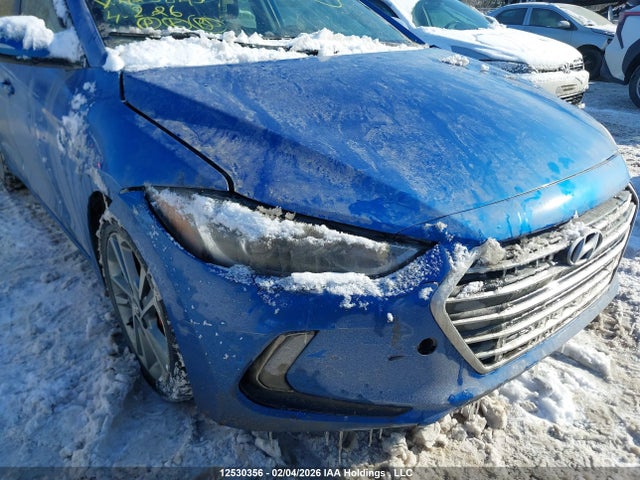 KMHD84LF5HU425845 Hyundai Elantra