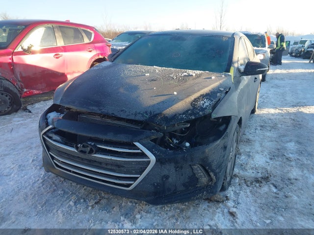 KMHD84LF3JU553362 Hyundai ELANTRA GL