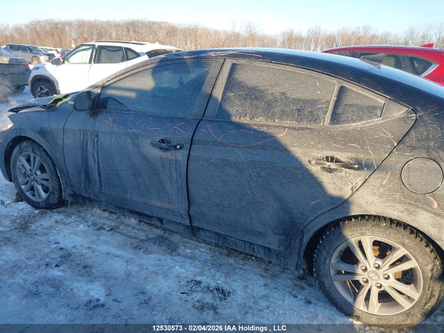 KMHD84LF3JU553362 Hyundai ELANTRA GL