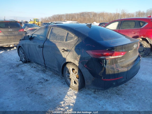 KMHD84LF3JU553362 Hyundai ELANTRA GL