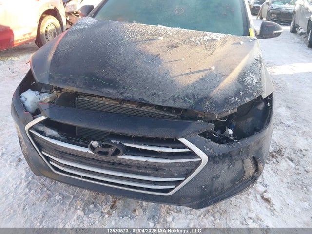 KMHD84LF3JU553362 Hyundai ELANTRA GL