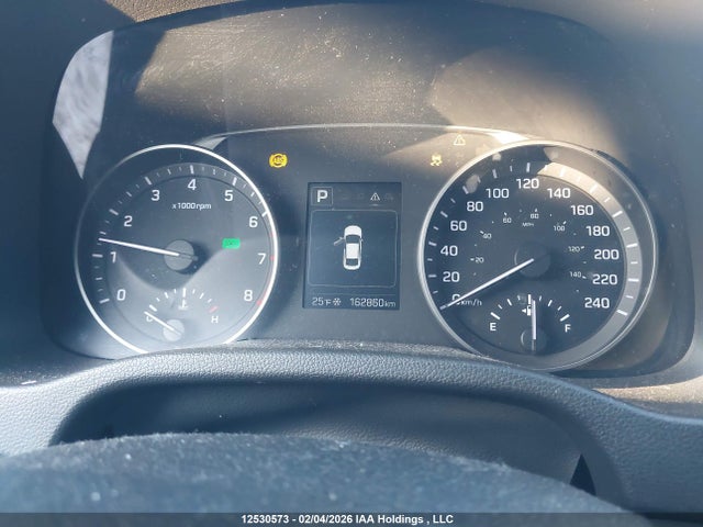 KMHD84LF3JU553362 Hyundai ELANTRA GL
