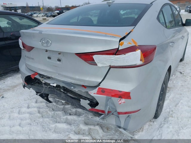 KMHD84LF4HU399383 Hyundai Elantra Se/value/limited