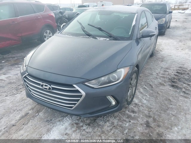 KMHD84LF1HU093662 Hyundai ELANTRA GL