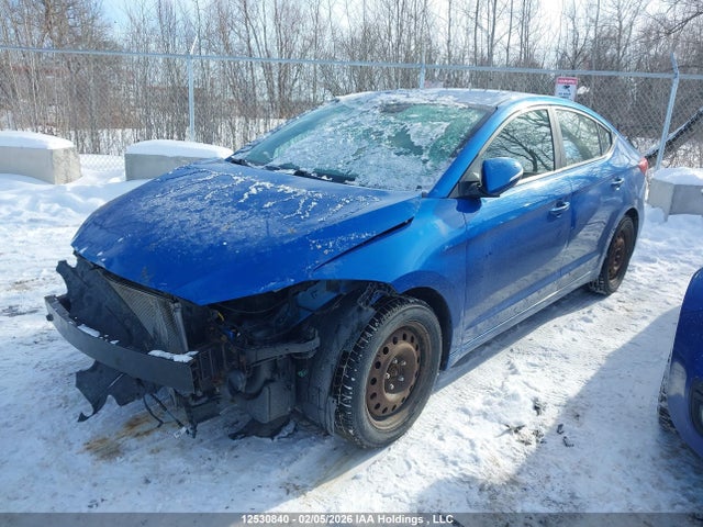 KMHD84LF4JU559476 Hyundai Elantra Sel/value/limited