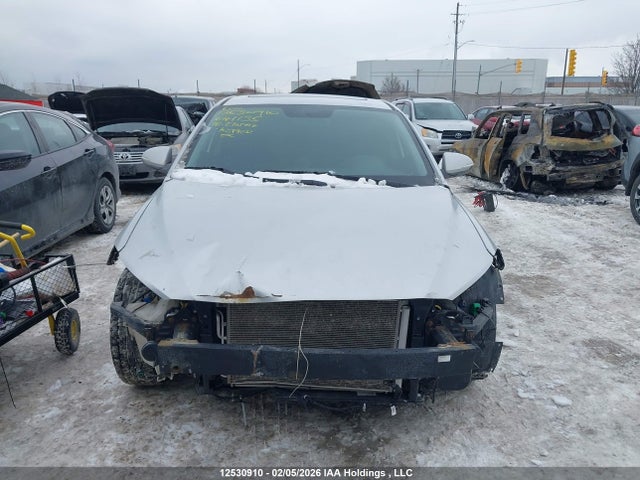 KMHD84LF5JU641135 Hyundai Elantra Gl Se