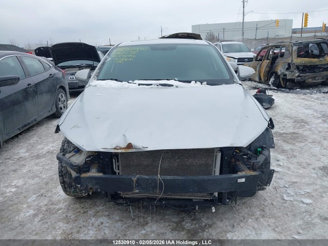 KMHD84LF5JU641135 Hyundai Elantra Gl Se