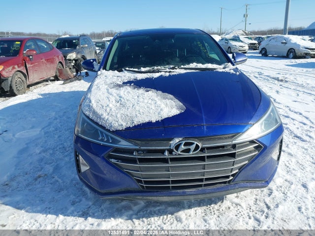 KMHD84LF1LU909360 Hyundai Elantra Sel/value/limited