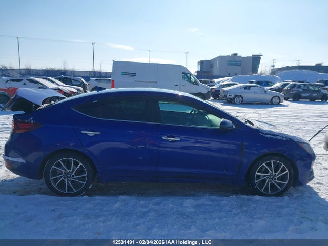KMHD84LF1LU909360 Hyundai Elantra Sel/value/limited