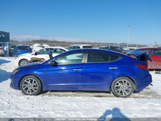 KMHD84LF1LU909360 Hyundai Elantra Sel/value/limited