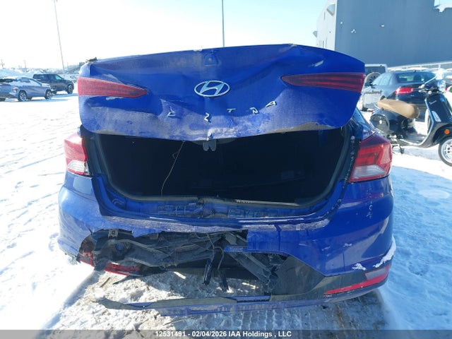 KMHD84LF1LU909360 Hyundai Elantra Sel/value/limited