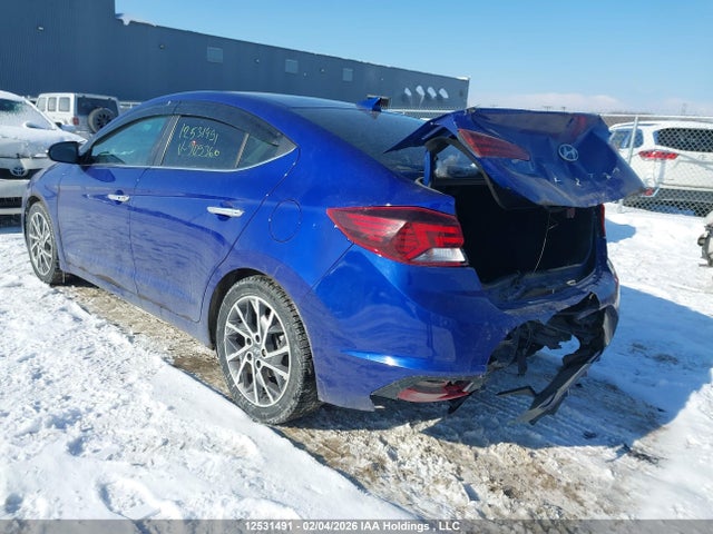 KMHD84LF1LU909360 Hyundai Elantra Sel/value/limited