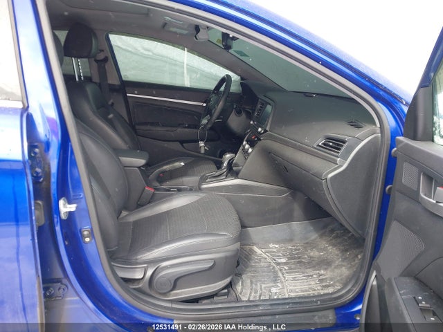 KMHD84LF1LU909360 Hyundai Elantra Sel/value/limited