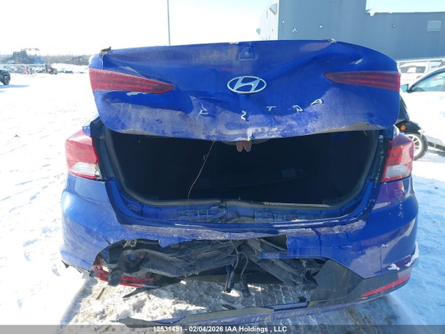 KMHD84LF1LU909360 Hyundai Elantra Sel/value/limited