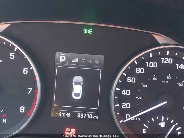 KMHD84LF0HU188472 Hyundai Elantra