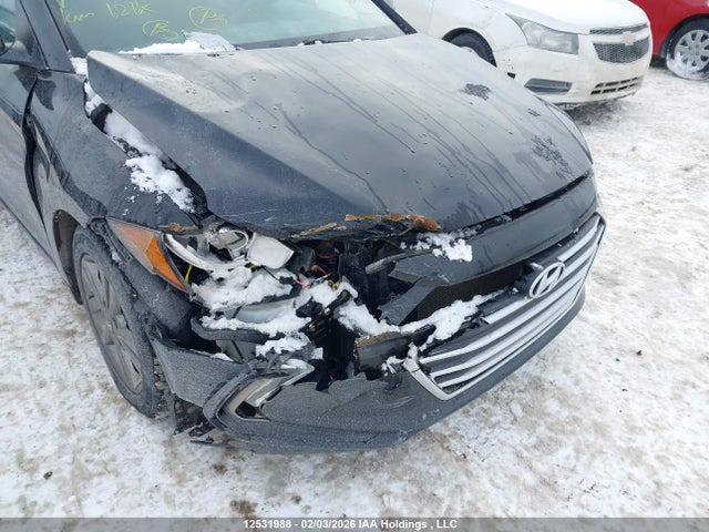 KMHD84LF6JU718031 Hyundai ELANTRA GL