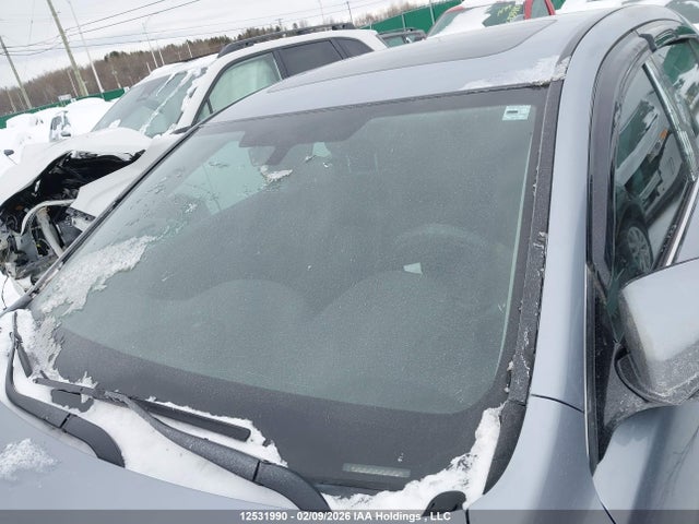 Acura TLX 2015 19UUB3F30FA802308 Image 17