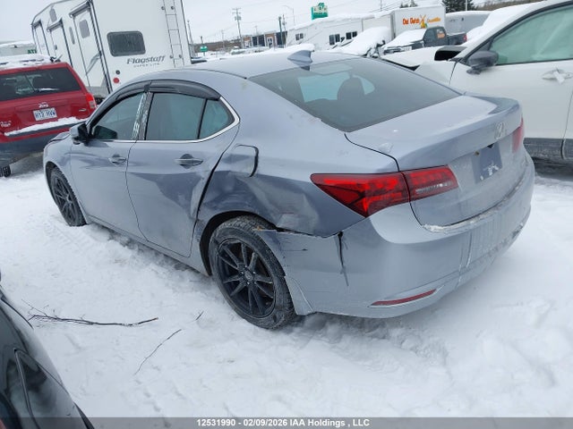 Acura TLX 2015 19UUB3F30FA802308 Image 3