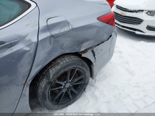 Acura TLX 2015 19UUB3F30FA802308 Image 6