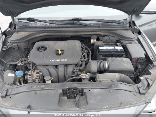 KMHD84LF0JU695636 Hyundai ELANTRA GL