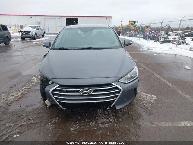 KMHD84LF0JU695636 Hyundai ELANTRA GL