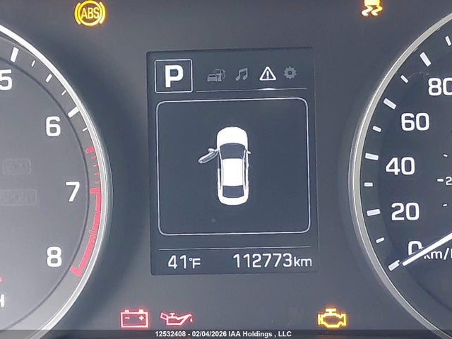 KMHD84LF7HU374672 Hyundai ELANTRA GL
