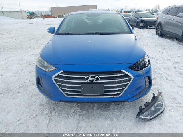 KMHD84LF6JU699190 Hyundai ELANTRA GL