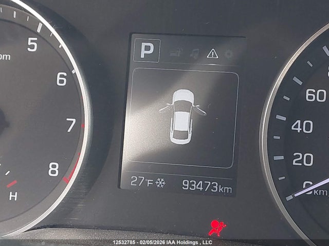 KMHD84LF6JU699190 Hyundai ELANTRA GL