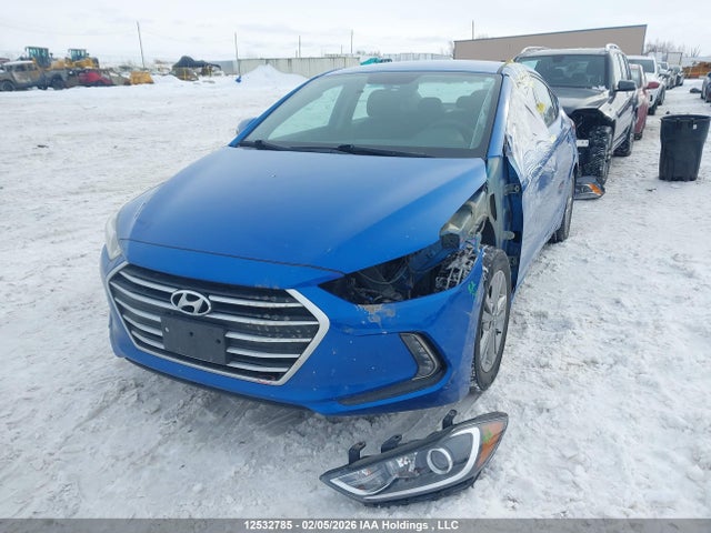 KMHD84LF6JU699190 Hyundai ELANTRA GL