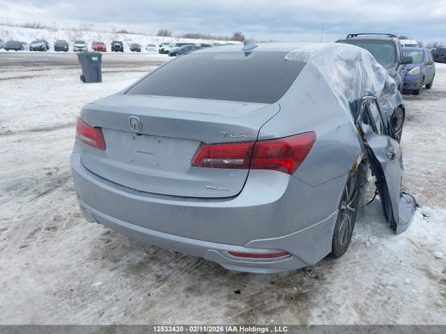 Acura TLX TECH 2015 19UUB3F54FA801664 Image 4