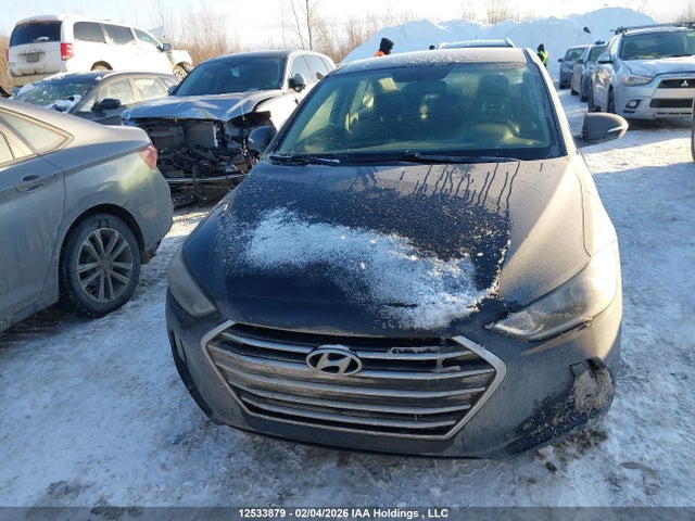 KMHD84LFXJU691030 Hyundai ELANTRA GL