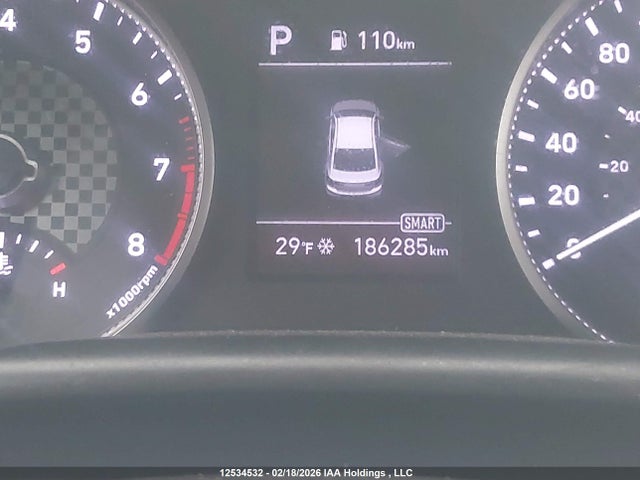 KMHD84LFXLU915304 Hyundai Elantra Sel/value/limited