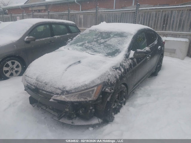 KMHD84LFXLU915304 Hyundai Elantra Sel/value/limited