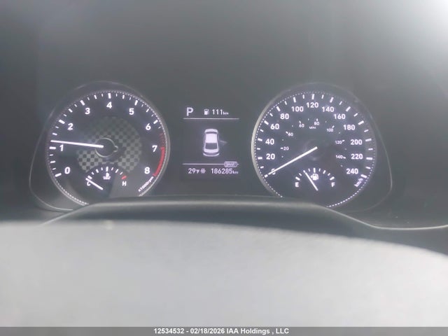 KMHD84LFXLU915304 Hyundai Elantra Sel/value/limited