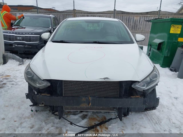KMHD84LF9HU399069 Hyundai ELANTRA GL