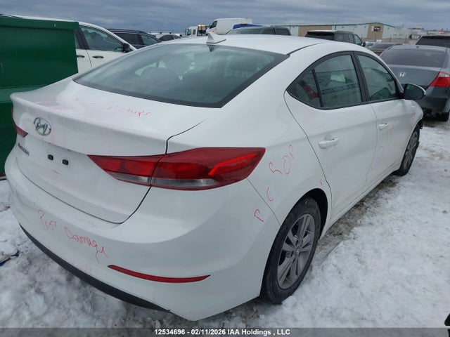 KMHD84LF9HU399069 Hyundai ELANTRA GL