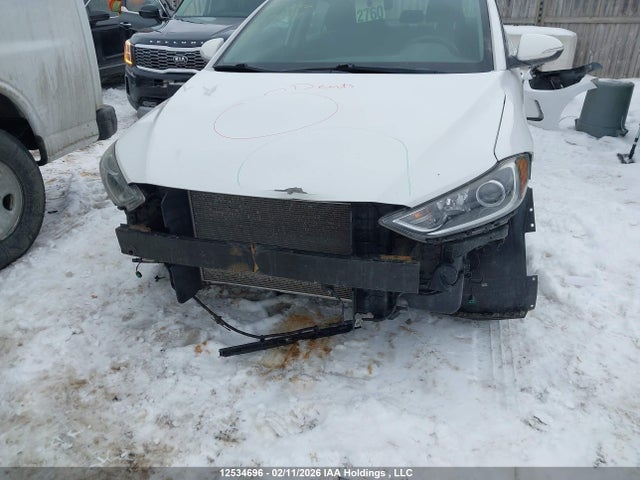 KMHD84LF9HU399069 Hyundai ELANTRA GL