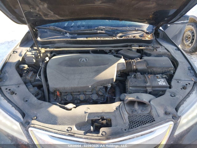 Acura TLX TECH 2015 19UUB3F55FA802807 Image 10