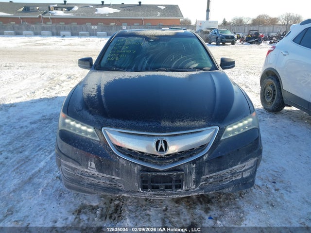 Acura TLX TECH 2015 19UUB3F55FA802807 Image 12